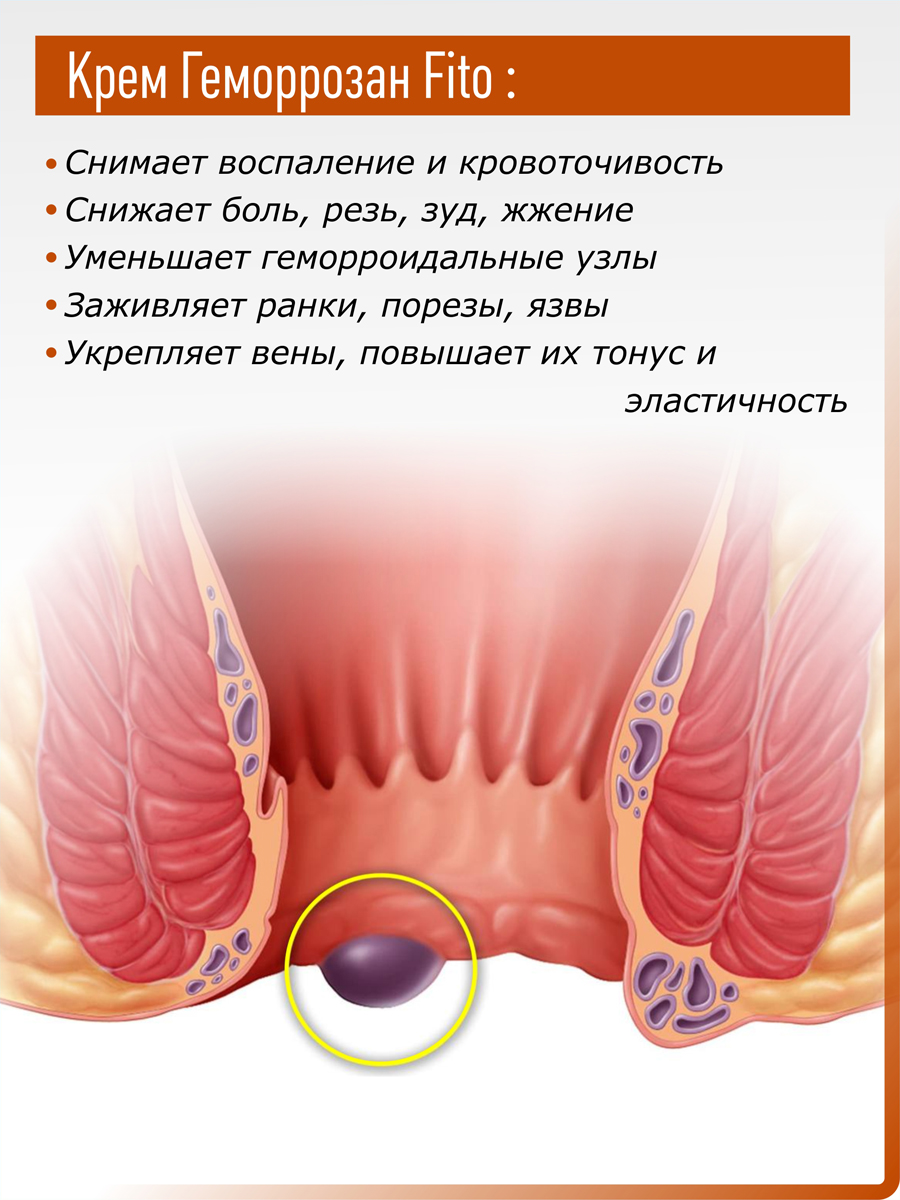 Комплект Крем Фитол-5. Геморрозан - Fito 2 шт купить в Москве в одном из  наших магазинов или с бесплатной доставкой по Москве в интернет-магазине по  низкой цене. Рецепты, применение, отзывы.