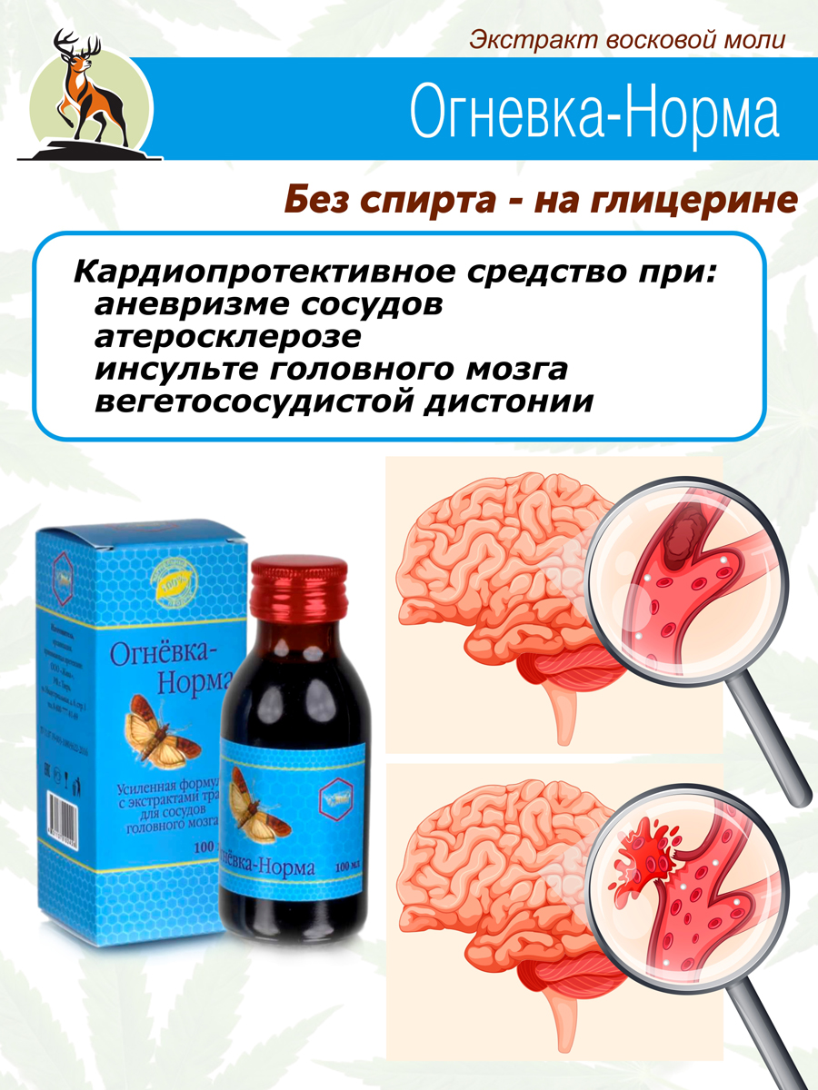 Чистка сосудов: что это, и можно ли убрать холестериновые бляшки?